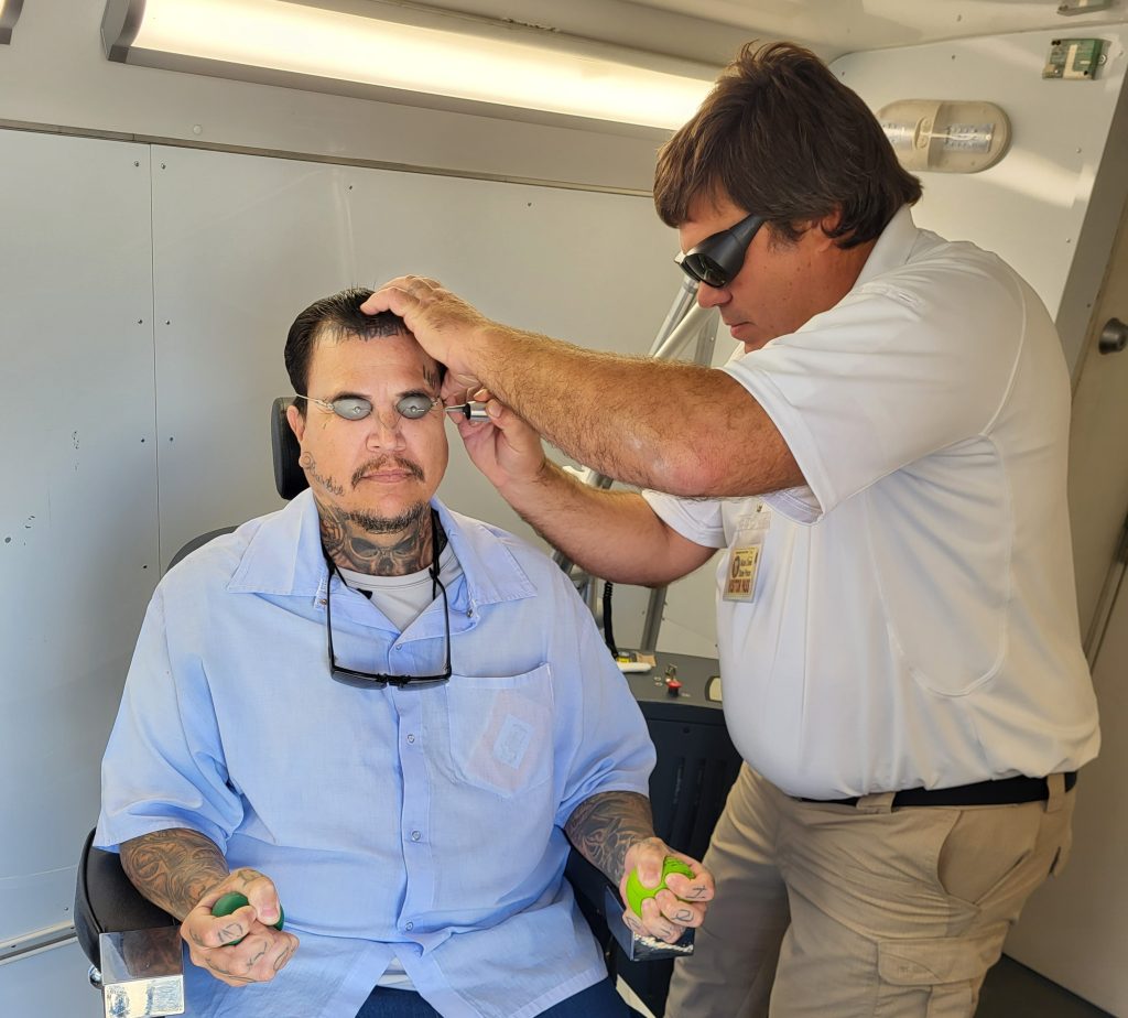 tattoo removal at MCSP