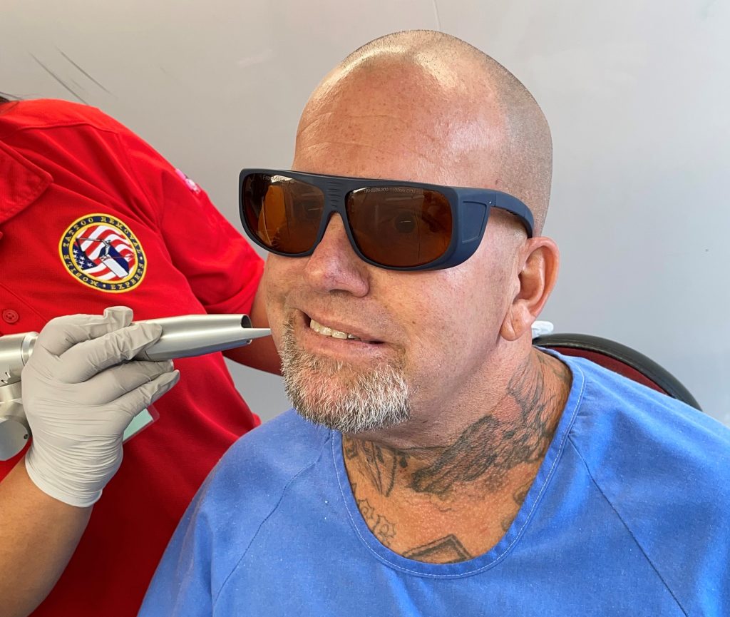 CAL incarcerated receiving tattoo removal