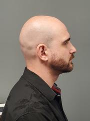 Side mugshot image of Joshua Phillip Metcalfe