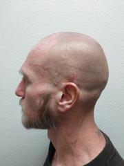 Side mugshot image of Jeremy Michael Gardner